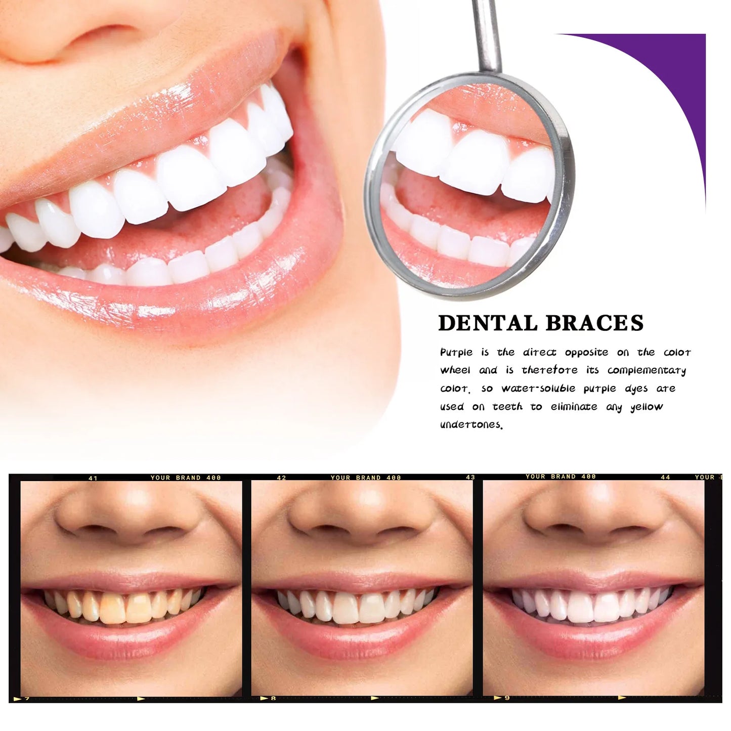 V34 Teeth Whitening Mousse – Whiten, Freshen & Protect Daily